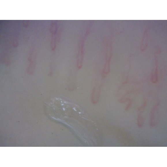 Digital Microscope Dino-Lite CapillaryScope 200 Pro (MEDL4N Pro)