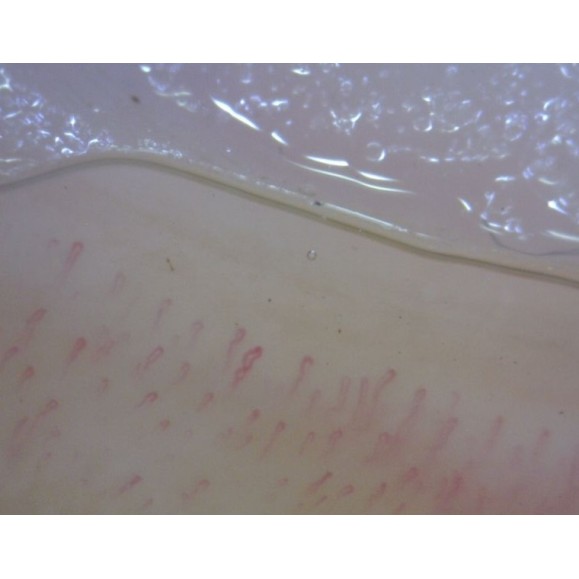 Digital Microscope Dino-Lite CapillaryScope 200 Pro (MEDL4N Pro)