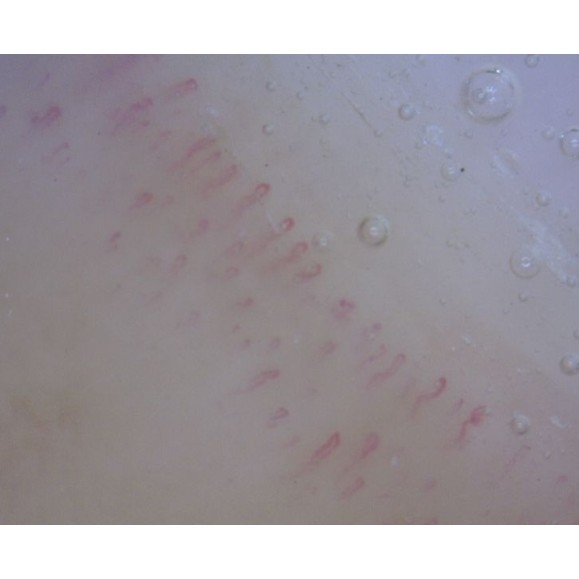 Digital Microscope Dino-Lite CapillaryScope 200 Pro (MEDL4N Pro)