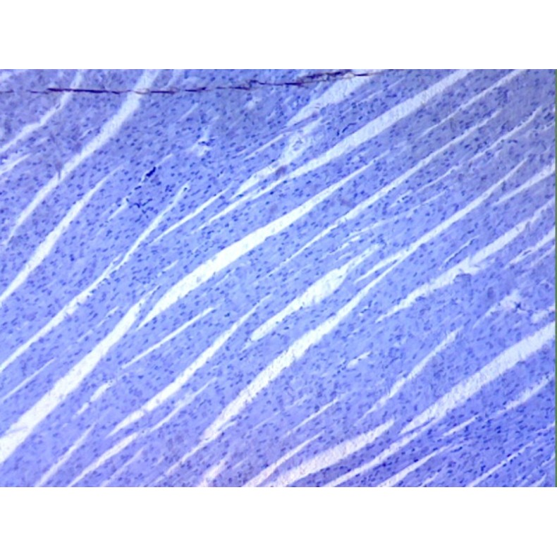 Box of preparations 100 units Box of preparations 100 units