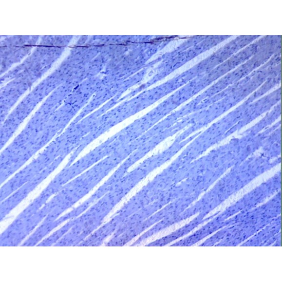 Box of preparations 100 units Box of preparations 100 units