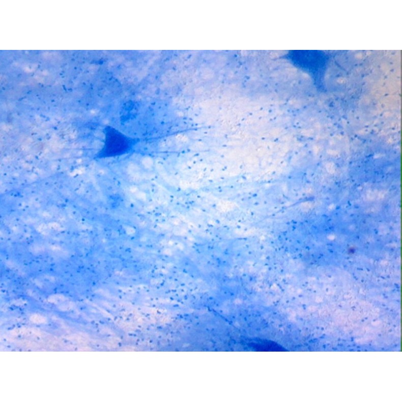 Box of preparations 100 units Box of preparations 100 units