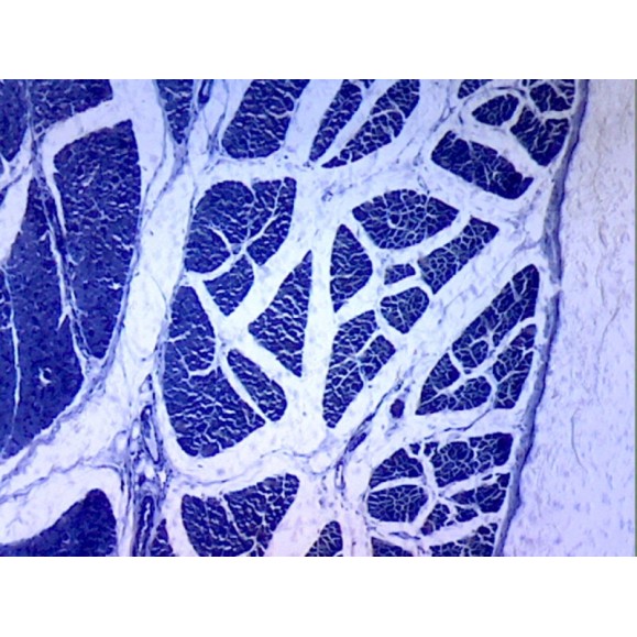 Box of preparations 100 units Box of preparations 100 units