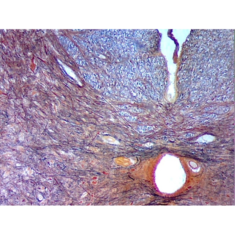 Box of preparations 100 units Box of preparations 100 units